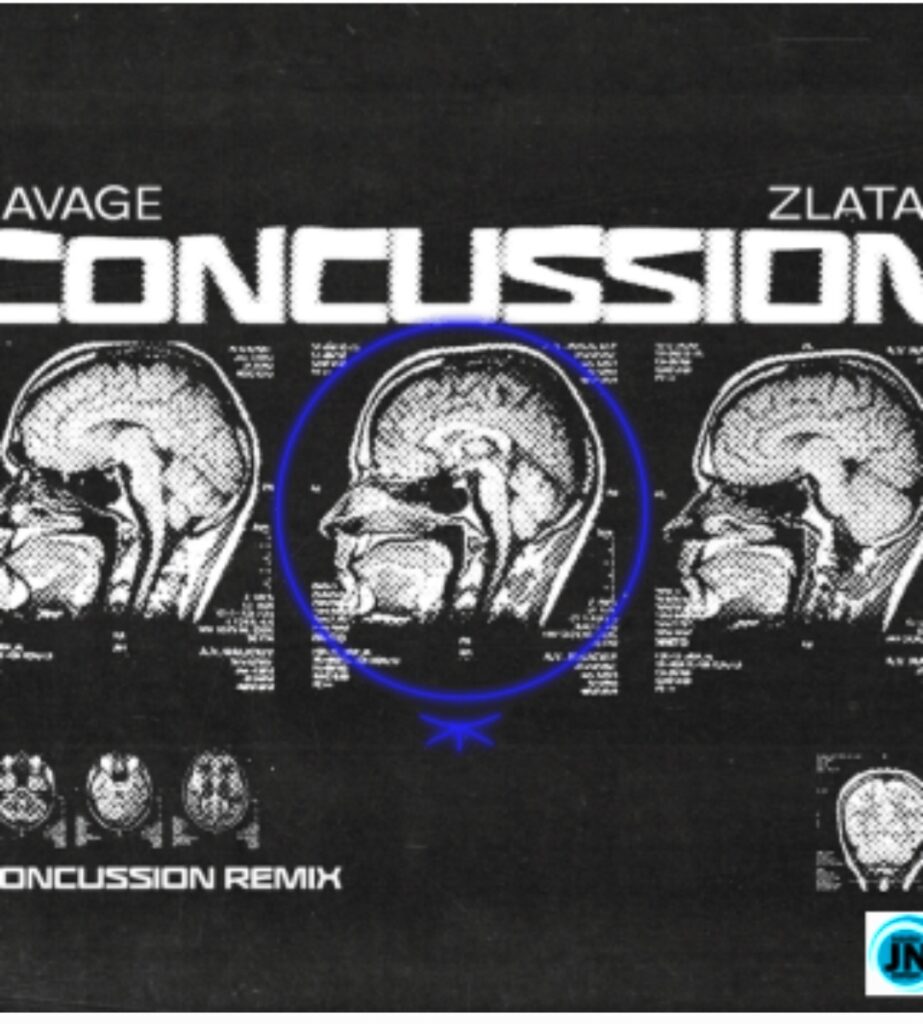 Savage – Concussion (Remix) ft. Zlatan